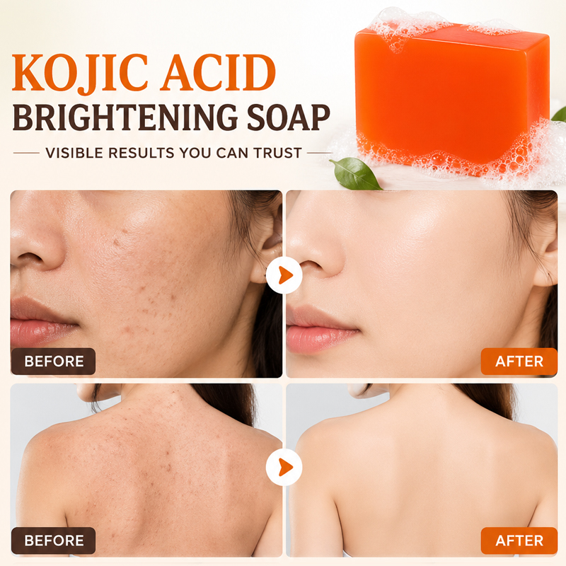 Kojic Acid Zeep 6-pack, Verhel - Glycolic Acid Exfoliant recensie en prijs