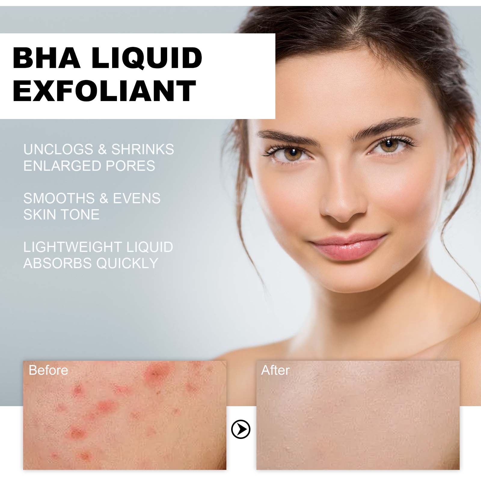 2% Salicylzuur Vloeibare Exfol - Glycolic Acid Exfoliant recensie en prijs