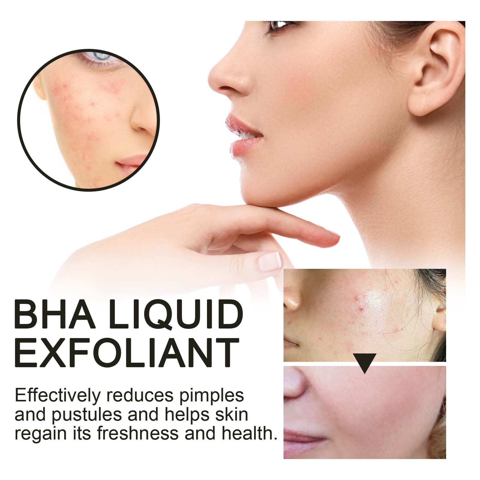2% Salicylzuur Vloeibare Exfol - Glycolic Acid Exfoliant recensie en prijs